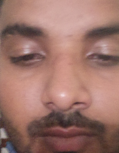 Rupesh kumar